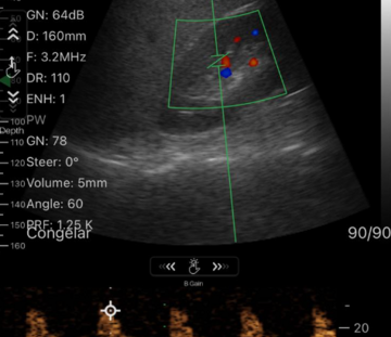 Curso Avanzado en Ultrasonografía General y Critica